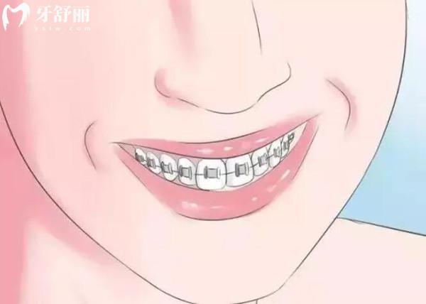 濱州口腔醫(yī)院牙齒矯正價(jià)格