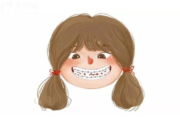 鋼絲矯正