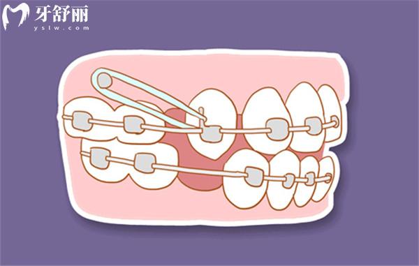 重慶口腔醫(yī)院拔牙多少錢