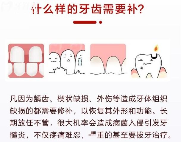 什么樣的牙齒需要補(bǔ)