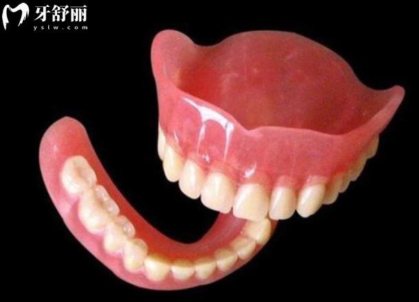活動(dòng)義齒的種類及價(jià)格