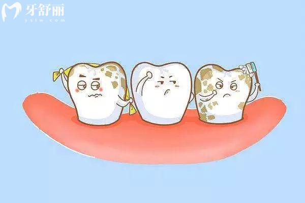 洗牙