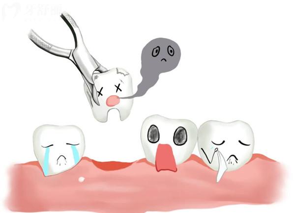 瑞爾齒科拔牙多少錢