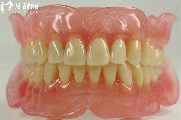紹興全口種植牙價(jià)格