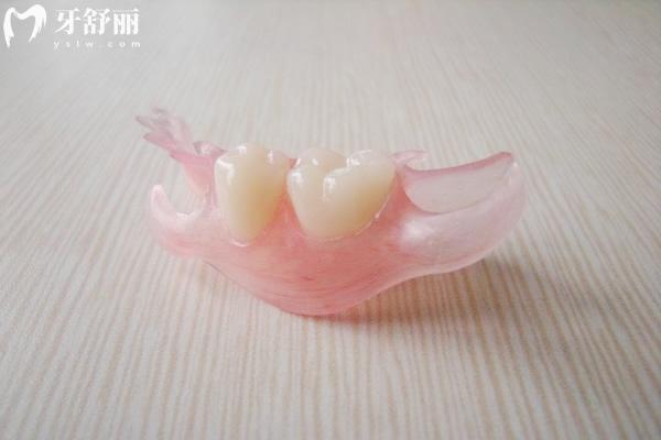 局部可摘義齒