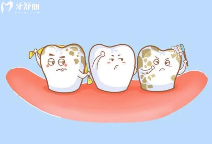 氟斑牙是怎么造成的