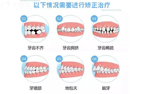 需要進(jìn)行牙齒治療的類型