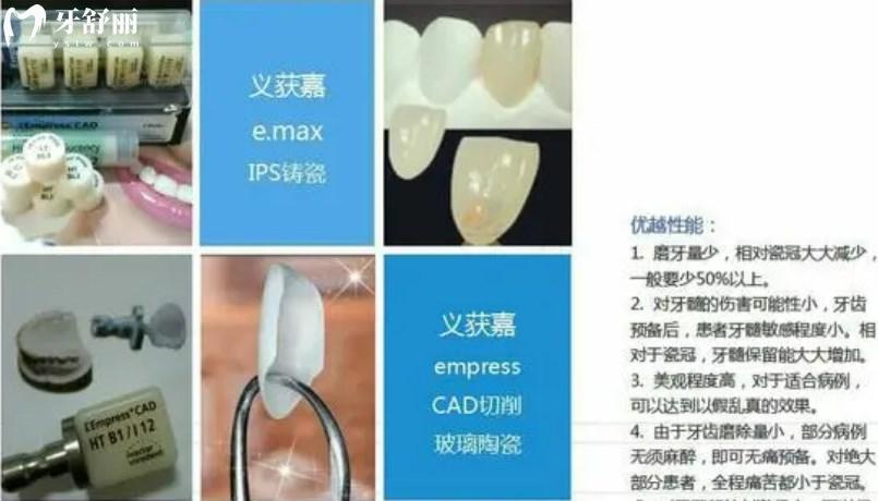 補牙材料的區(qū)別