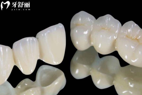 宜春牙科收費(fèi)價(jià)格標(biāo)準(zhǔn)--鑲牙