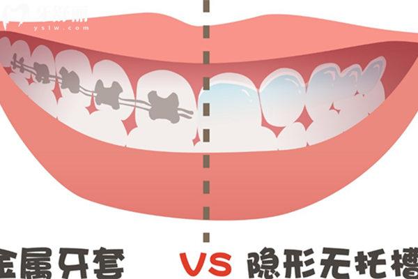 邯鄲牙齒矯正價格