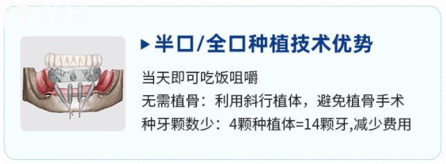 中諾口腔種植牙價(jià)格表2023,國產(chǎn)2800+韓國3980+瑞士8900+
