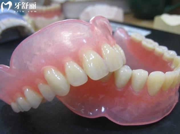 半口吸附性義齒