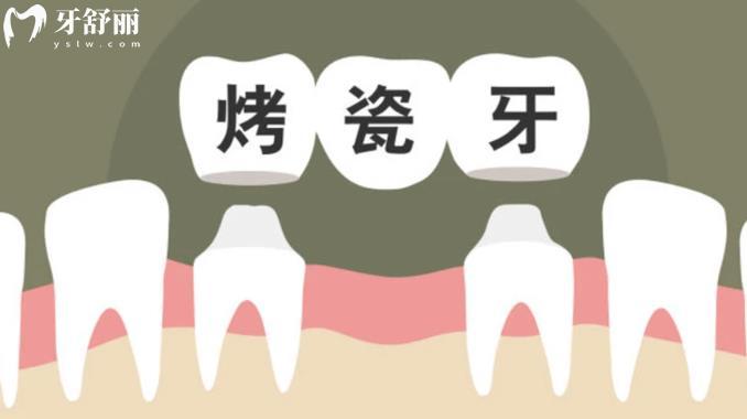 做完烤瓷牙幾年后口臭怎么辦