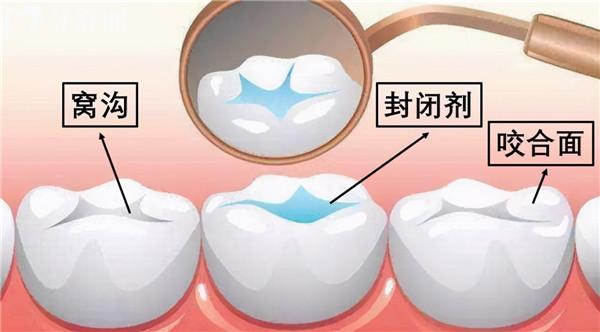 西安諾貝爾牙科地址有哪幾家