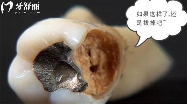 爛牙根長(zhǎng)期不拔的危害