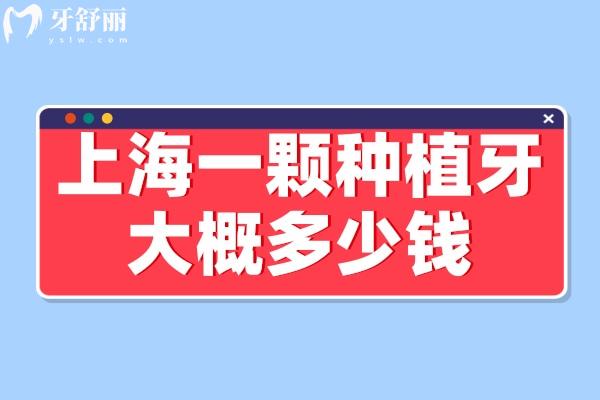 上海種植牙的價格大概是多少錢一顆
