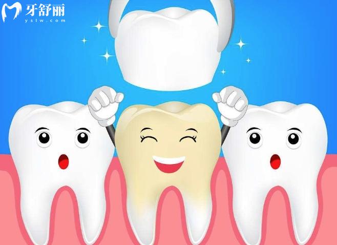 做烤瓷牙前需要做根管治療嗎