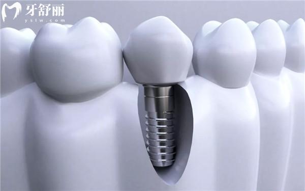 重慶牙博士口腔(榮昌分院)怎么樣