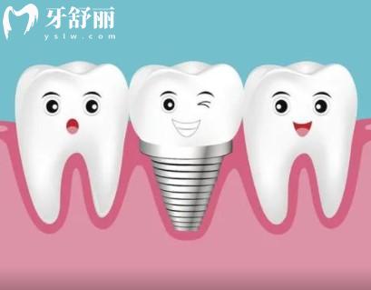 黃石種植滿口牙費用是多少