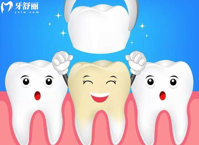 卡塔納全瓷牙是哪國的?是日本的質(zhì)量好硬度高屬于中等檔次價格3000起