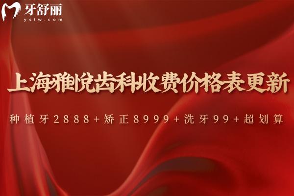 上海雅悅齒科收費(fèi)價(jià)格表更新:種植牙2888+矯正8999+洗牙99+超劃算