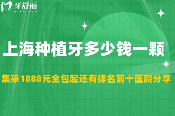 上海種植牙多少錢一顆2023年?集采1888元全包起還有排名前十醫(yī)院分享