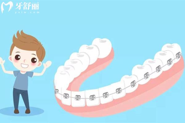 北京瑞泰口腔牙齒矯正多少錢