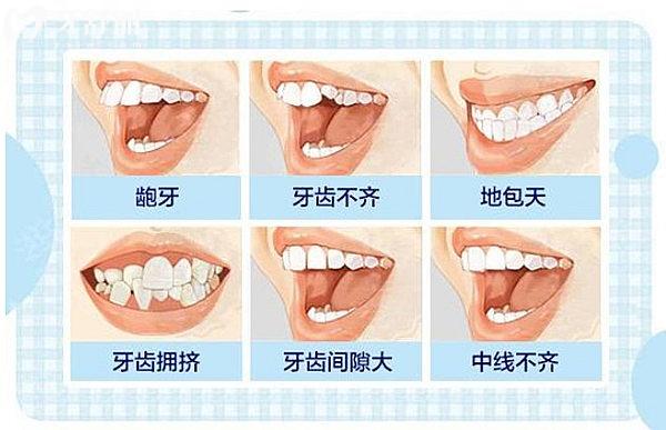 保定二醫(yī)院牙科牙齒矯正的費(fèi)用