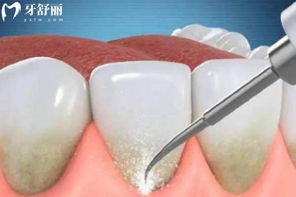 連云港牙科收費(fèi)價(jià)目表