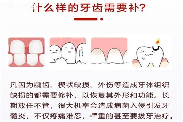 補牙