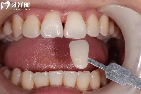 高郵牙科醫(yī)院收費標(biāo)準(zhǔn)