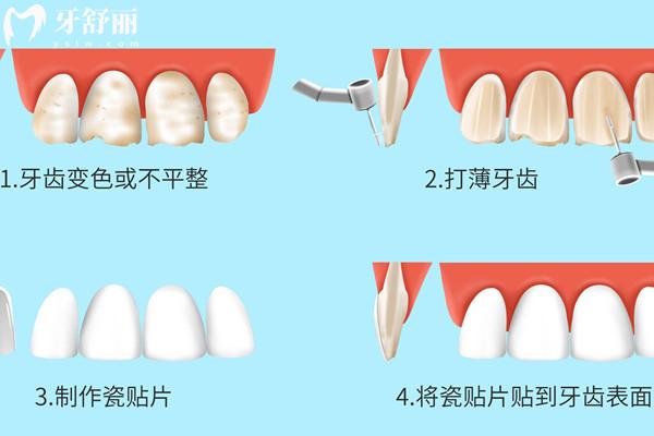 杭州鼎植口腔醫(yī)院收費標準