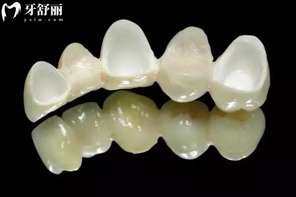 資陽(yáng)牙科醫(yī)院收費(fèi)標(biāo)準(zhǔn)表