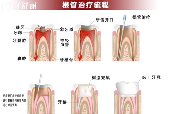 自貢牙科醫(yī)院收費(fèi)價(jià)目表
