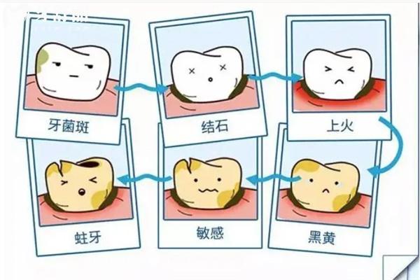 牙齒不好