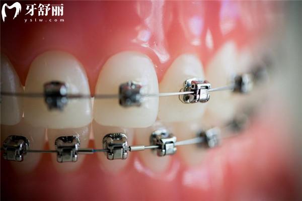 桂林正如口腔怎么樣?可刷社?？ǖ恼?guī)牙科口碑好收費(fèi)也便宜