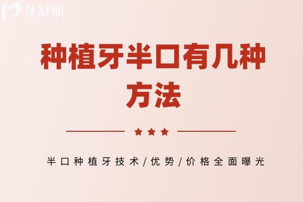 種植牙半口有幾種方法