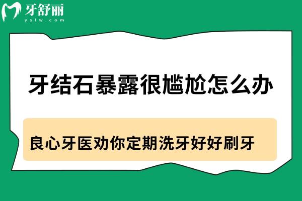牙結(jié)石暴露很尷尬怎么辦?良心牙醫(yī)勸你定期洗牙好好刷牙