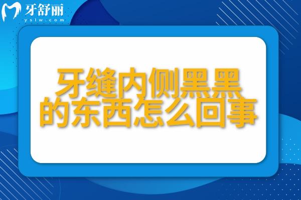 牙縫內(nèi)側(cè)黑黑的東西怎么回事？快來(lái)了解原因和解決方法