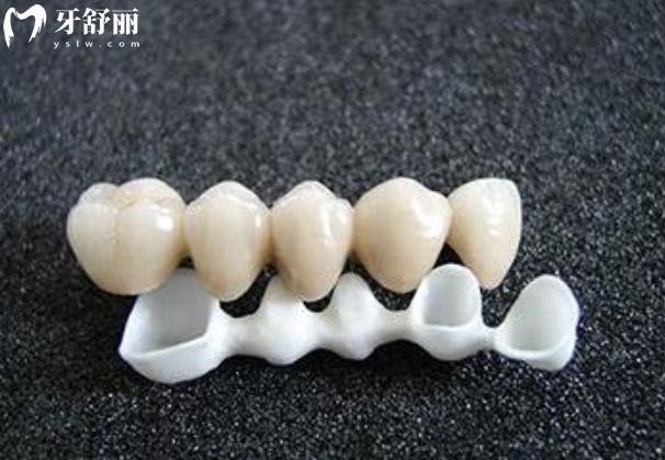 門牙用國產(chǎn)的還是進口的全瓷牙好