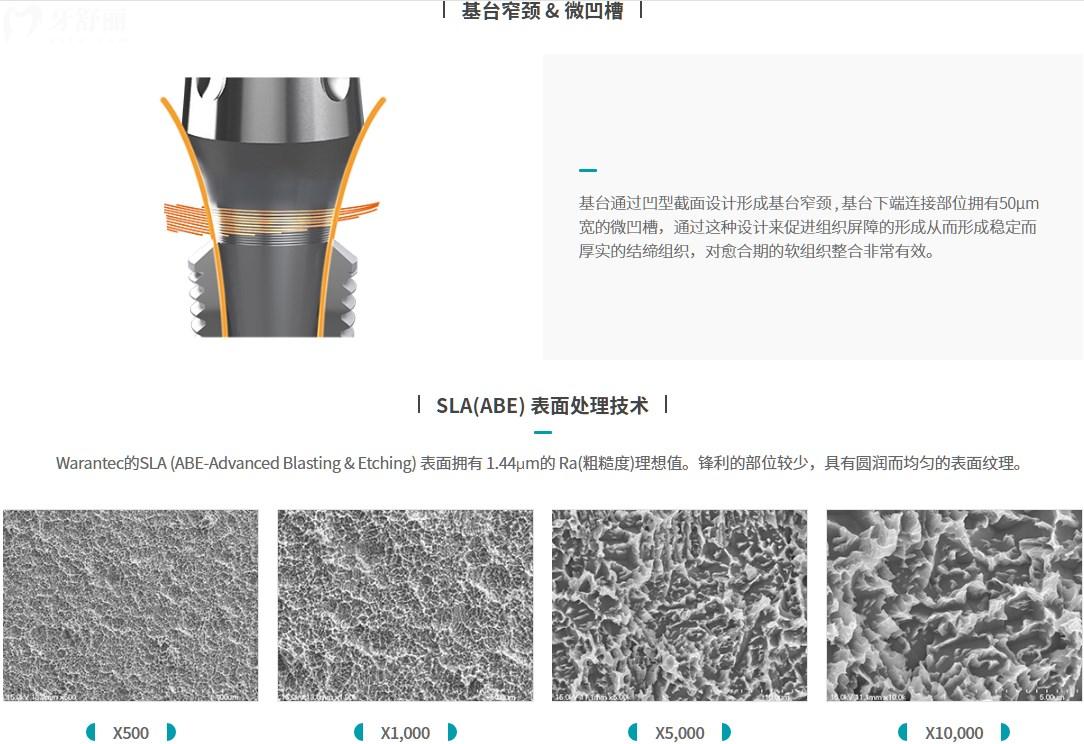種植牙四級(jí)鈦/五級(jí)鈦和合金哪個(gè)好