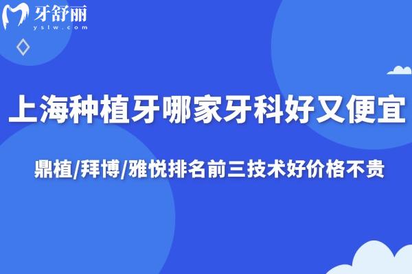 上海種植牙哪家牙科好又便宜?鼎植/拜博/雅悅排名前三技術(shù)好價(jià)格不貴