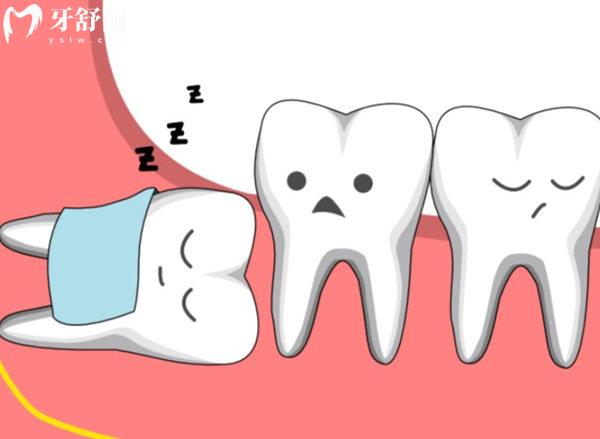 什么樣的智齒需要拔掉呢