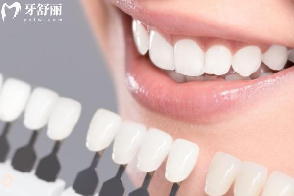 牙齒美白哪種方法好還沒副作用