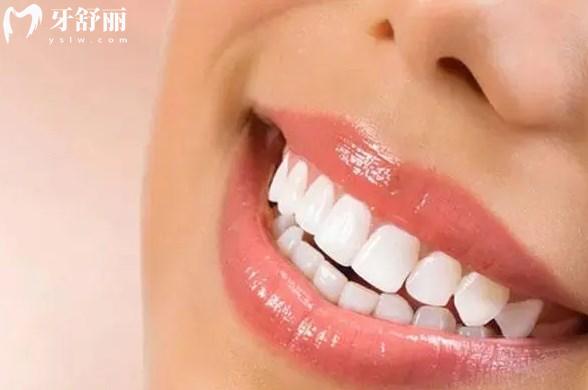 冷光牙齒美白要多少錢