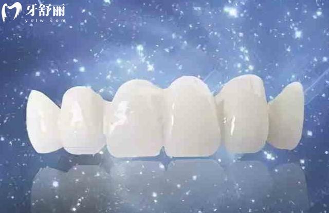 全瓷牙有幾種材質(zhì)