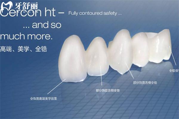 德國(guó)澤康(Cercon)全瓷牙冠