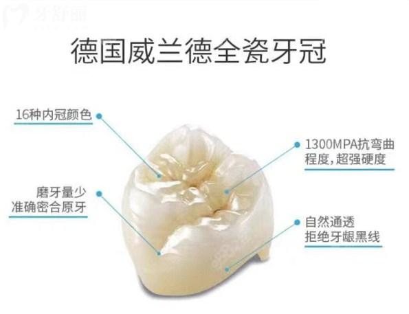 德國(guó)威蘭德全瓷牙冠