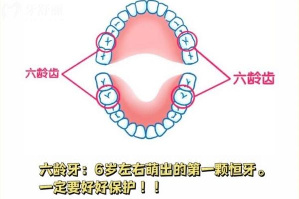 家長(zhǎng)問(wèn)窩溝封閉有必要嗎