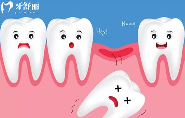 牙齒缺失千萬不要拖！以免增加治療費(fèi)用！